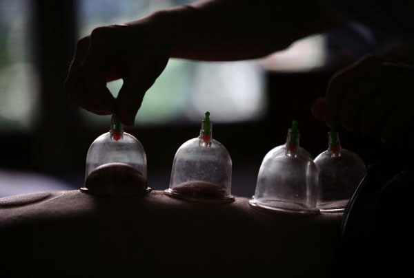 Non-Muslim Olympians Doing Prophetic Hijama? - About Islam