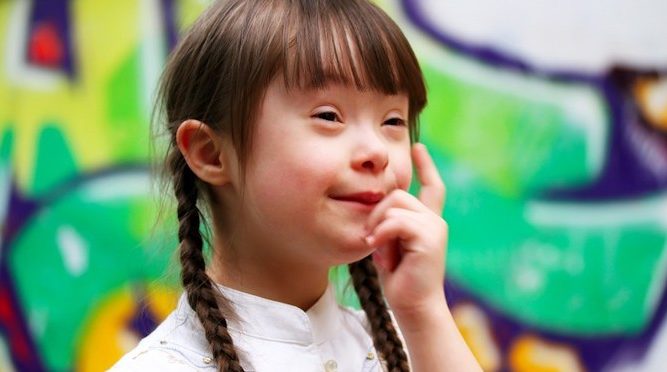 Down's Syndrome | About Islam