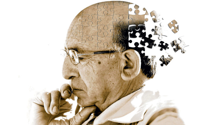 Does Dad Suffer from Dementia?