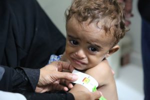 UN Agencies: Yemen Humanitarian Crisis Worst in the World - About Islam