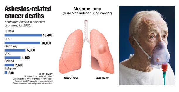 Breathe & Die: Evil Asbestos Lives On