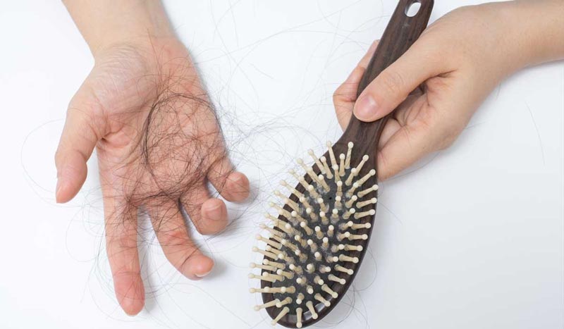 Hair Loss: Solving Riddle