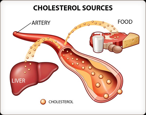 Is Cholesterol Really the Worst Problem?