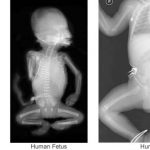 Atacama Desert Mummy Found in to Be Tiny, Mutated Child - About Islam