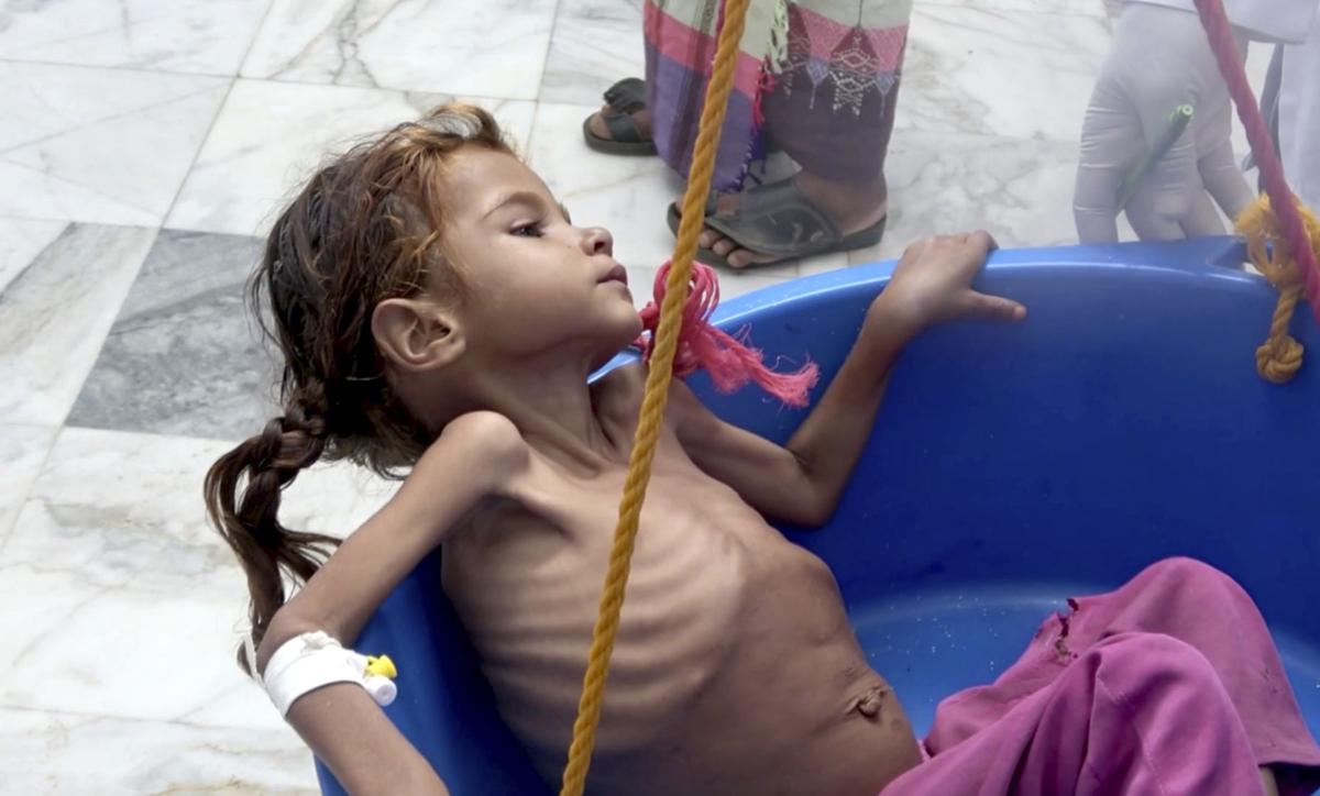 Yemeni Children Eat Leaves to Stave Off Famine