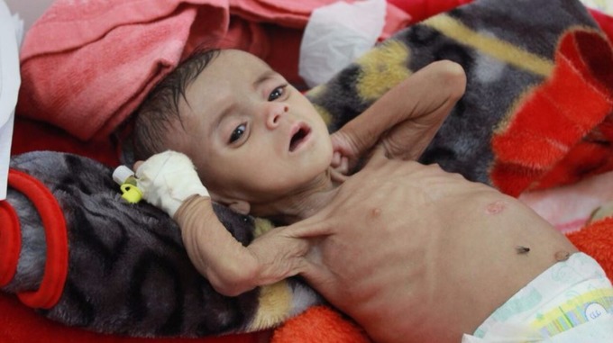 Yemeni Children Eat Leaves to Stave Off Famine - About Islam