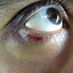 What Does Islam Say About Domestic Violence