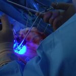 Glowing Chemical Can Aid Brain Cancer Surgery - About Islam