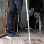Artificial Limbs Change Lives for Gazans - About Islam