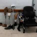 Artificial Limbs Change Lives for Gazans - About Islam
