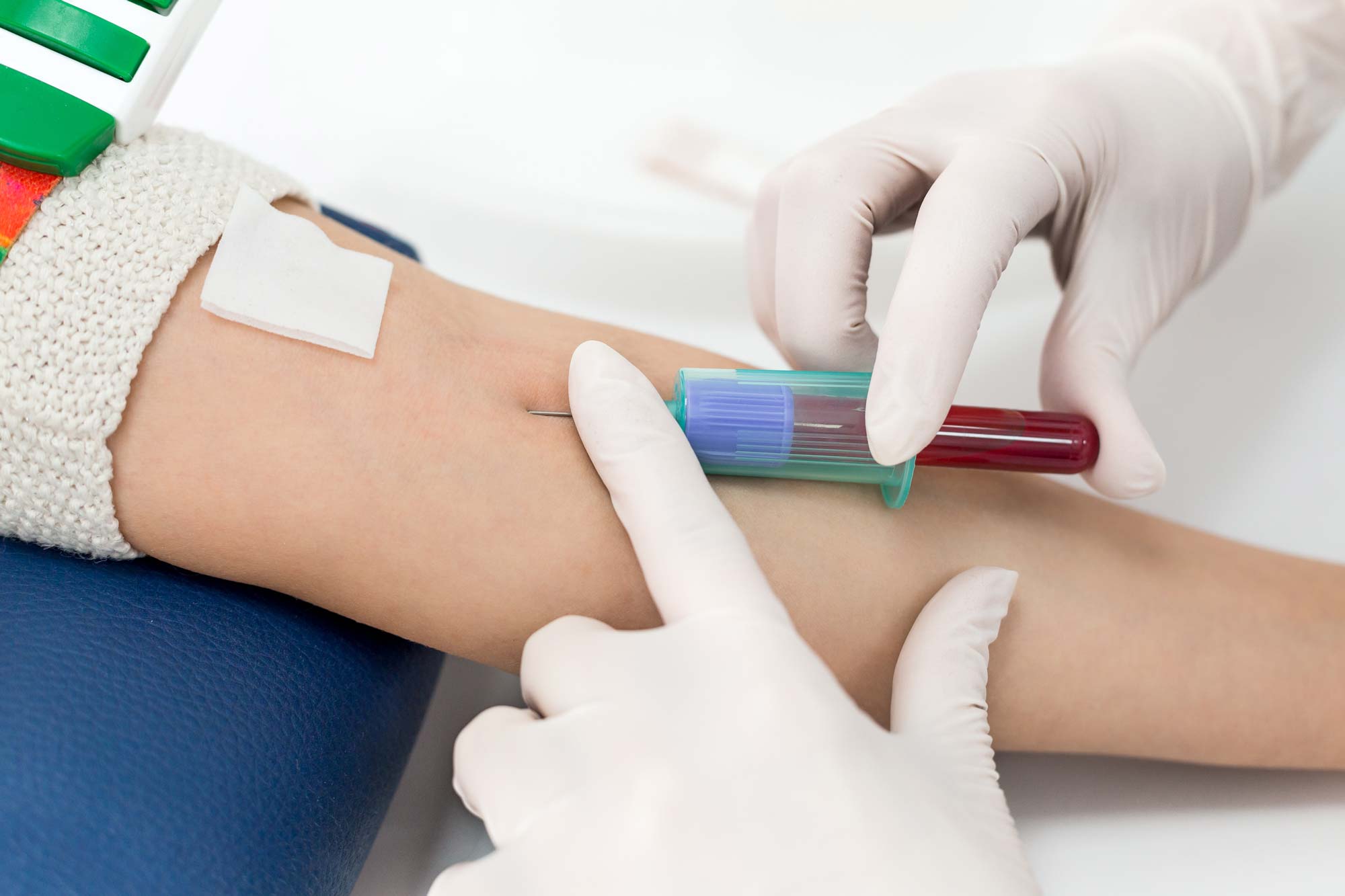 Does Blood Test Invalidate Fasting?