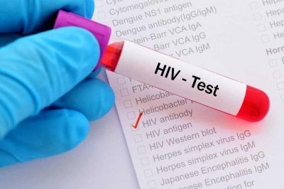 Is It Necessary to Undergo HIV Test Before Marriage?