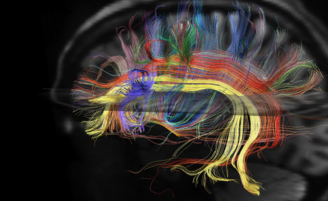 Rewiring Brain to Stick to Ramadan Resolutions - About Islam